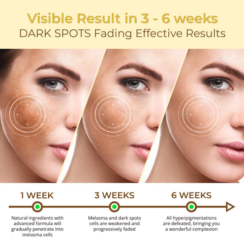 ABERA Kasumi Melasma Cream, Melasma Treatment with Niacinamide, Dark Spot Remover For Face, Reduce Fine Lines, Wrinkles, Anti-aging, Red Ginseng Extract, Glowing Cream (0.7 Oz Per Item) (1 Box)