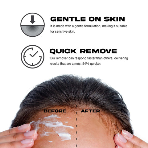 EBIN NEW YORK Wonder Lace Wig Adhesive Remover Spray - 4.05oz/ 120ml | Non-Irritating Formula Effectively Removes Adhesive Residue and Gentle Use on Hair Line