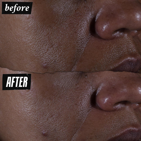 Kiehl's Ultra Pure High-Potency 9.8% Glycolic Acid Serum, Concentrated Face Serum to Exfoliate for Glowy Skin, Visibly Smooths Skin Texture & Boosts Skin Glow, All Skin Types, Fragrance-free - 1 fl oz