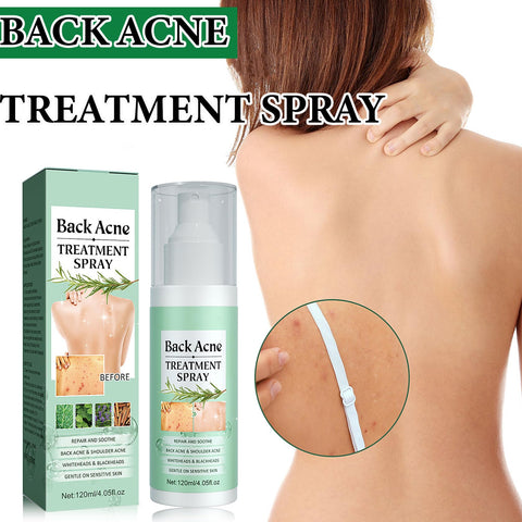 Back Acne Treatment,Back Acne Spray with Salicylic & Tea Leaf Oil Formula,Salicylic Acid Spray,Acne Body Spray Bacne Spray Natural Acne Treatment,Acne Spray for Back and Body